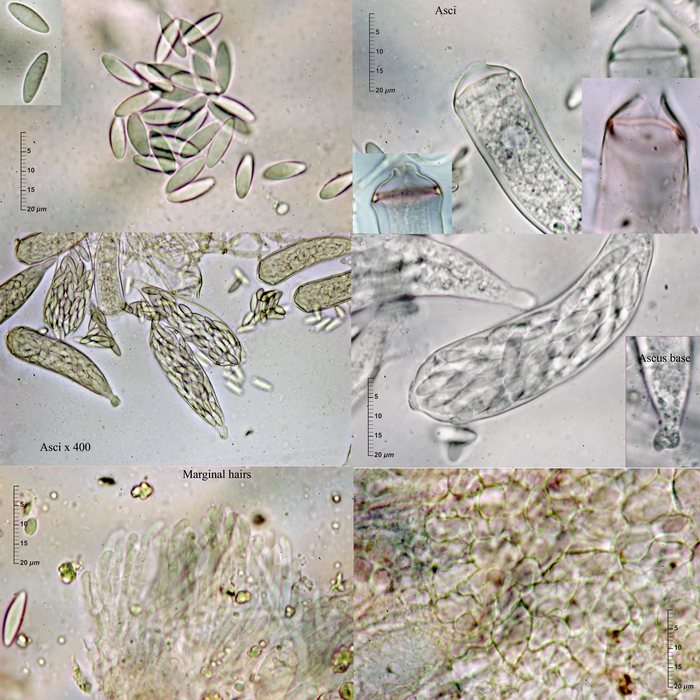 macrostoma