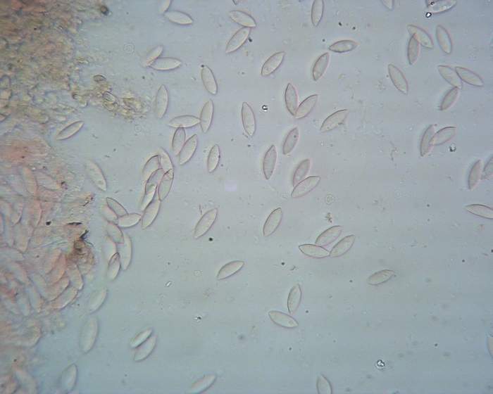 macrostoma