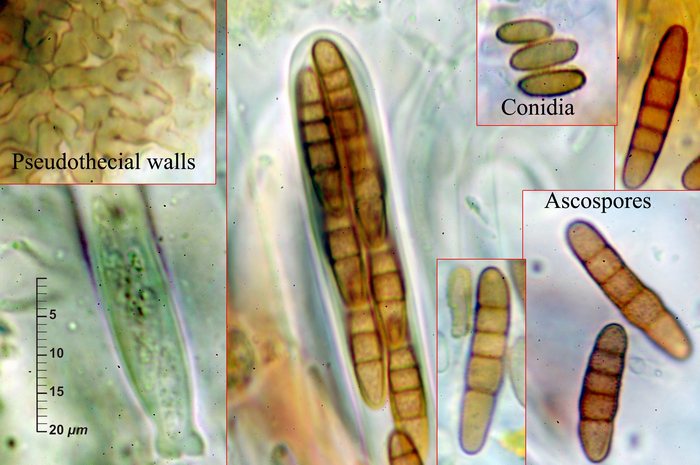 macrostoma