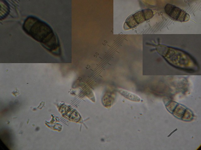 macrostoma