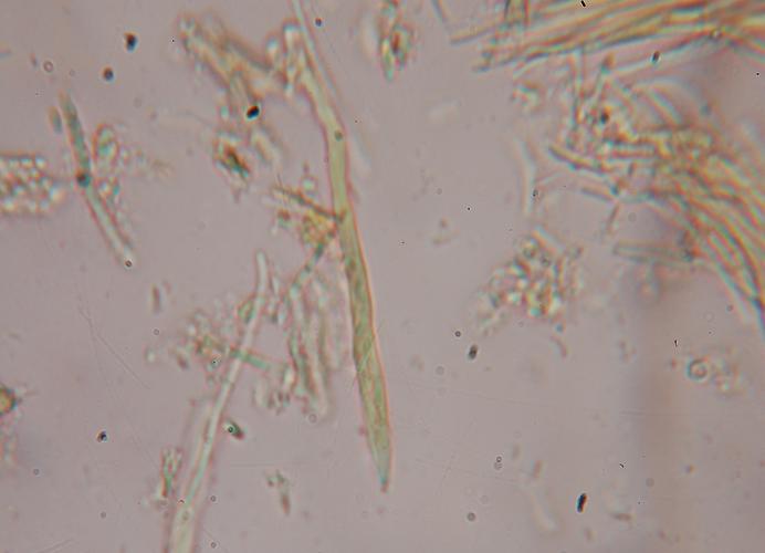 macrostoma