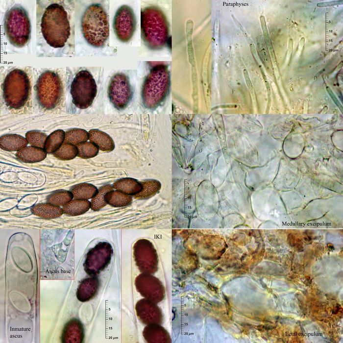 macrostoma