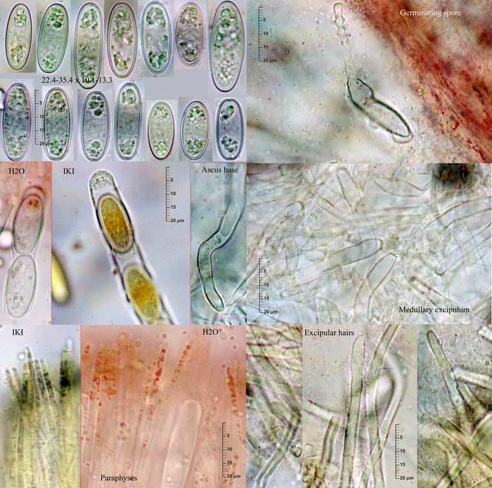 macrostoma