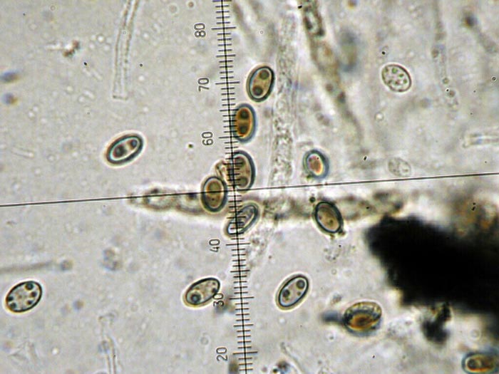 macrostoma