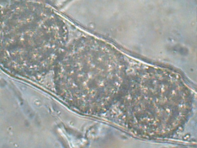 macrostoma