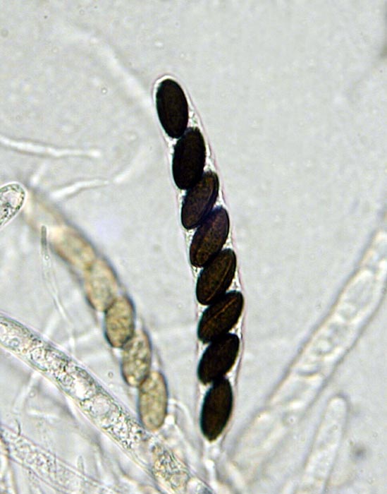 macrostoma
