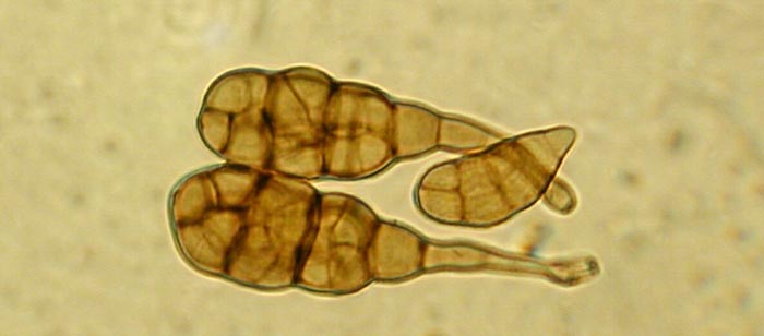 macrostoma