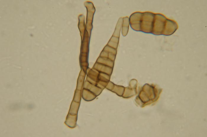 macrostoma