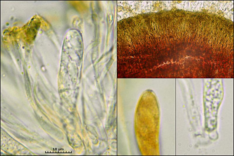 macrostoma