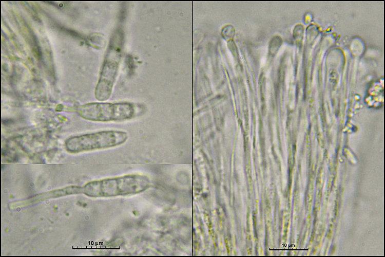 macrostoma