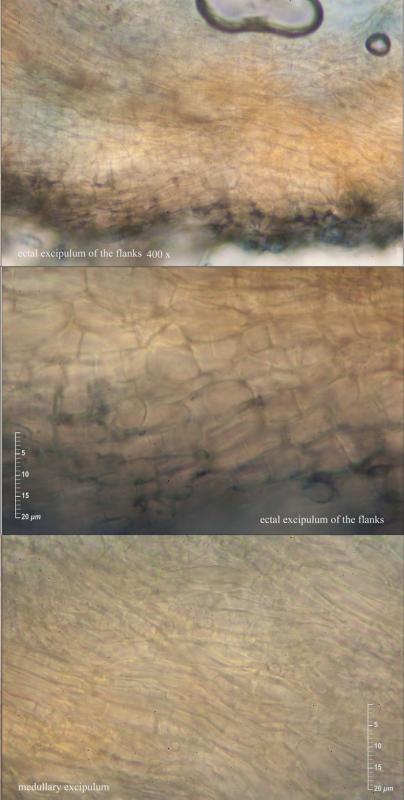 macrostoma