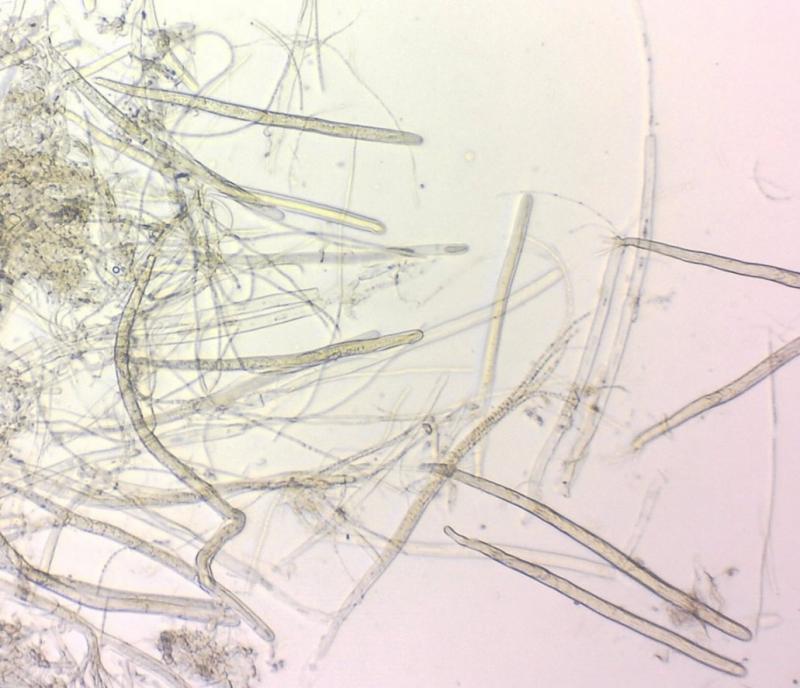 macrostoma