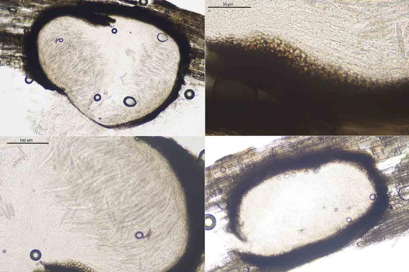 macrostoma