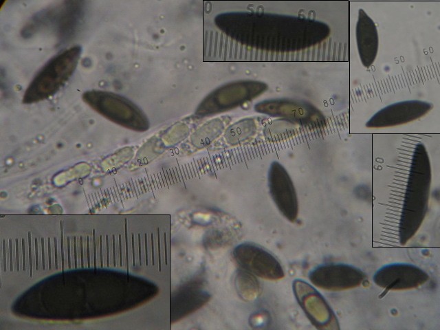 macrostoma