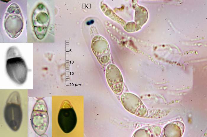 macrostoma