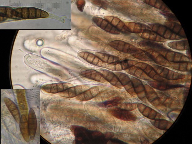 macrostoma