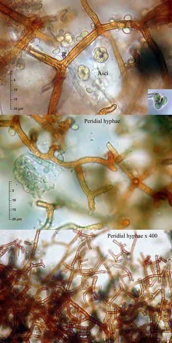 macrostoma