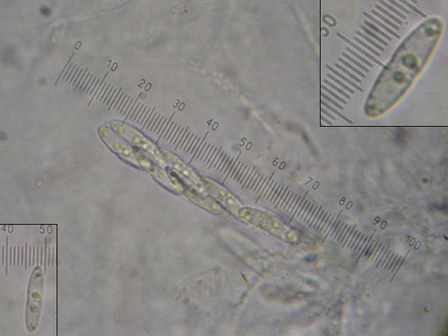 macrostoma
