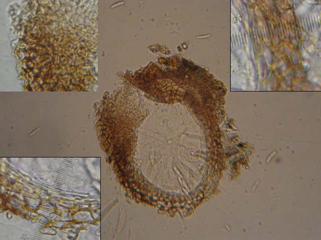 macrostoma