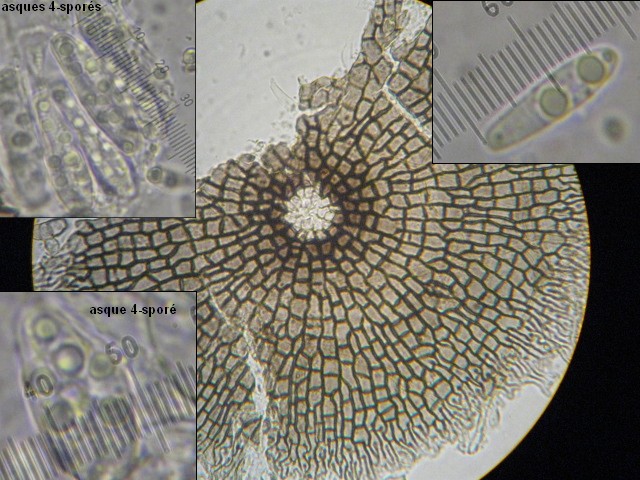 macrostoma