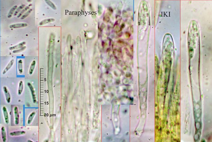 macrostoma