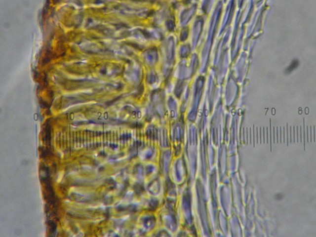 macrostoma
