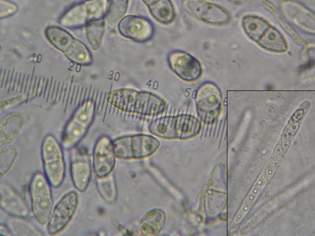 macrostoma