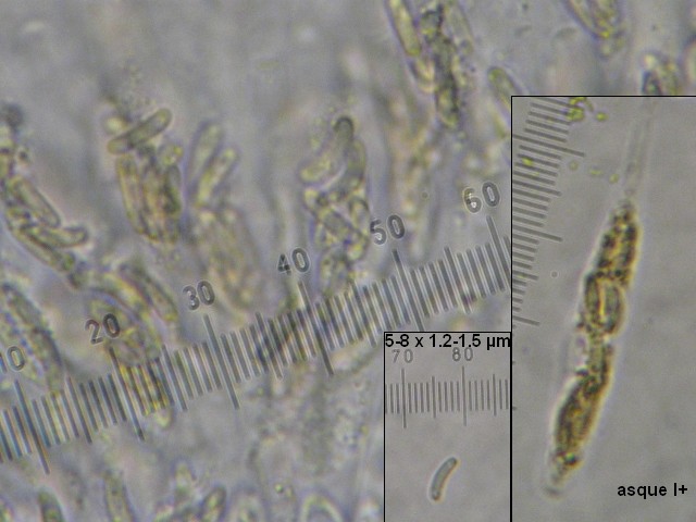 macrostoma
