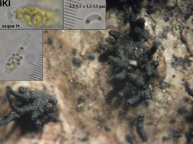macrostoma