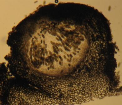 macrostoma