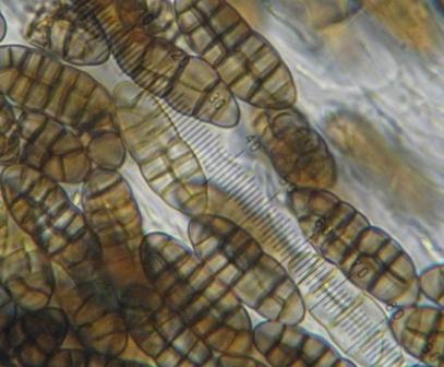 macrostoma