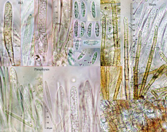 macrostoma