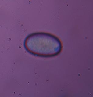 macrostoma