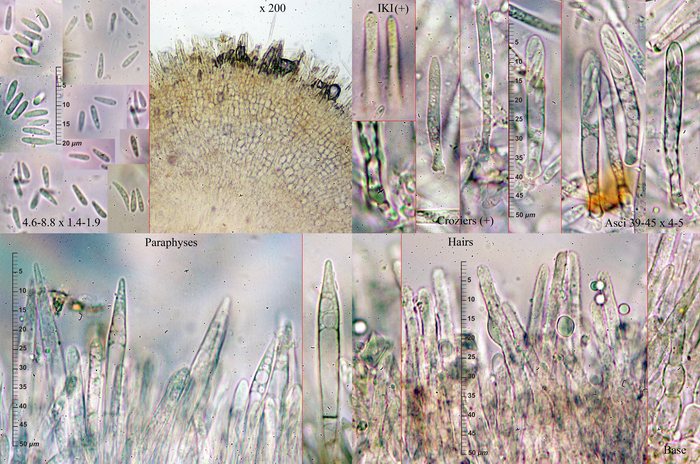 macrostoma