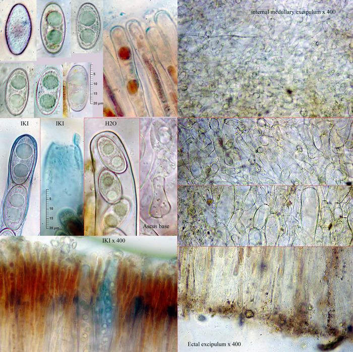 macrostoma