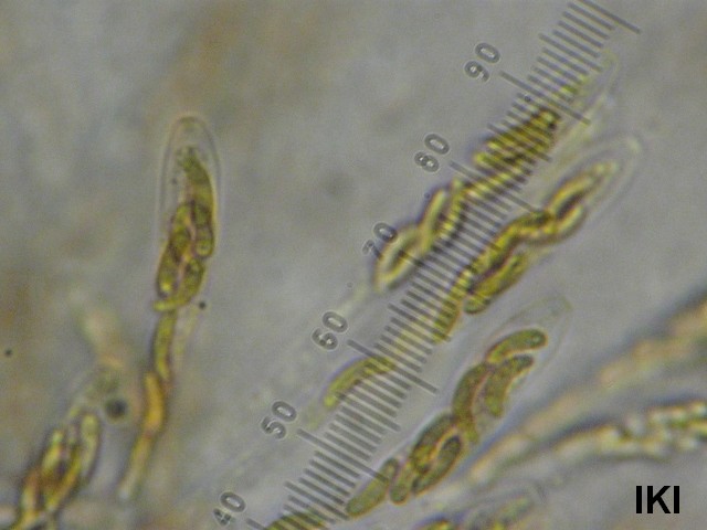 macrostoma