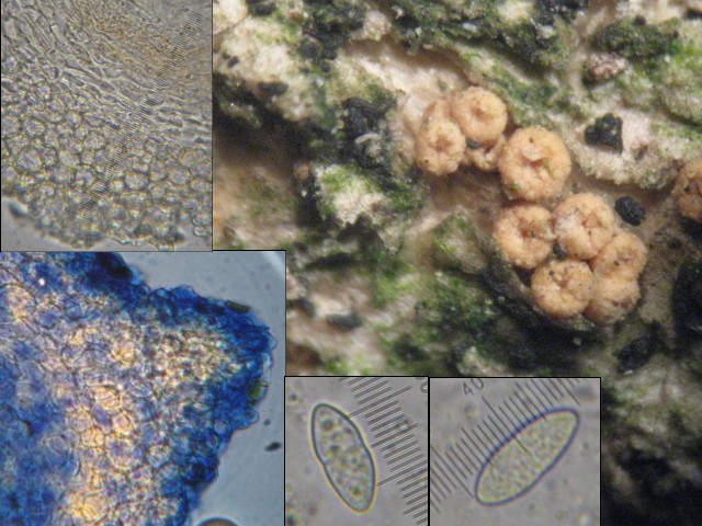 macrostoma