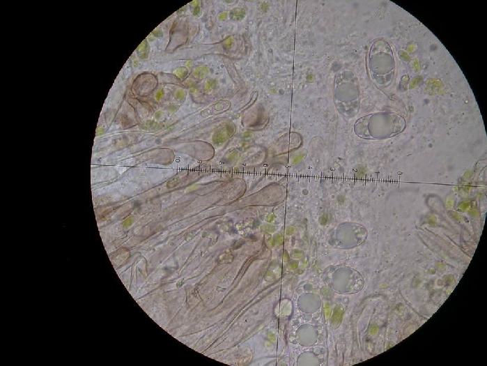macrostoma
