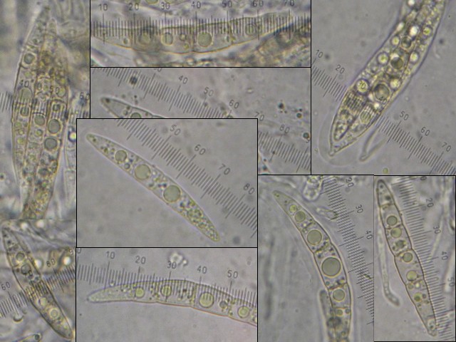 macrostoma