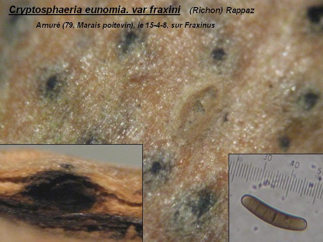 macrostoma