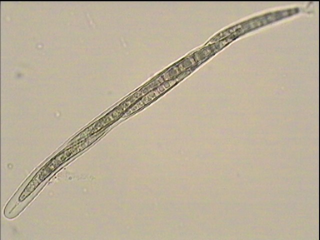 macrostoma