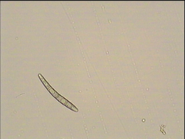 macrostoma