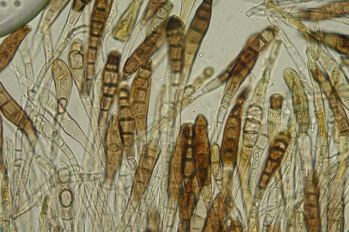 macrostoma