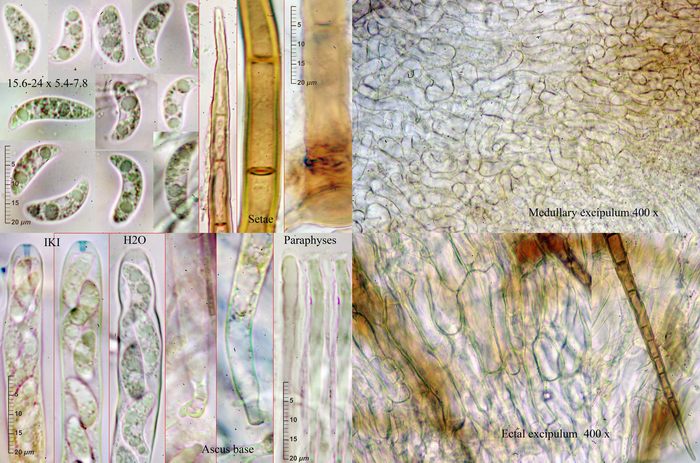 macrostoma