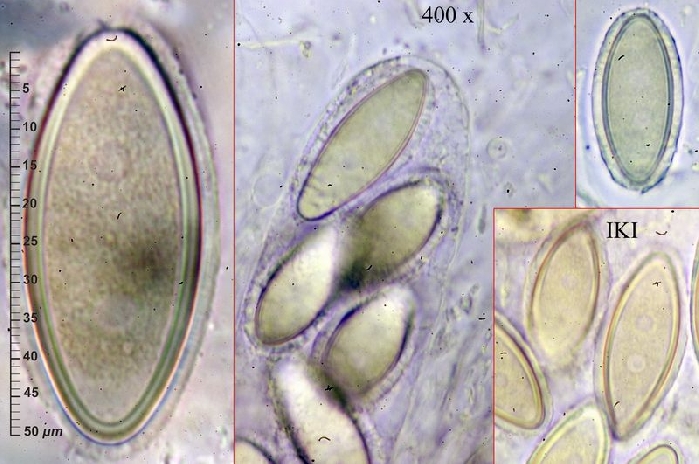 macrostoma