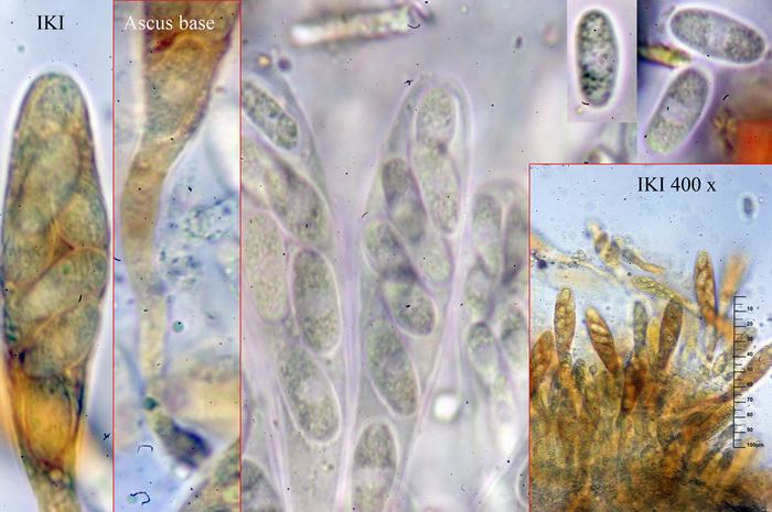 macrostoma