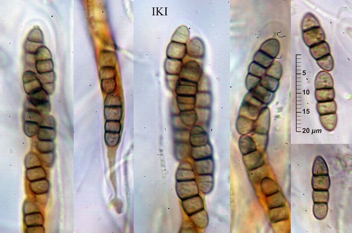 macrostoma