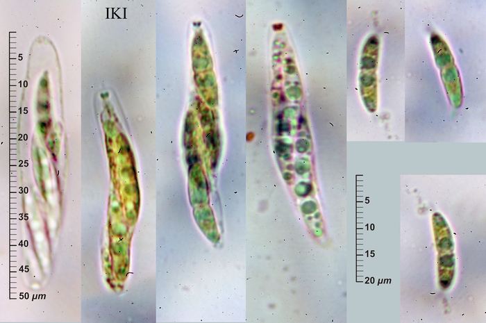 macrostoma