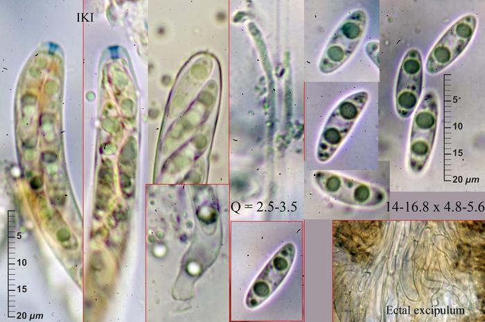 macrostoma
