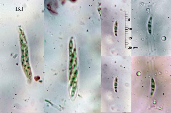 macrostoma